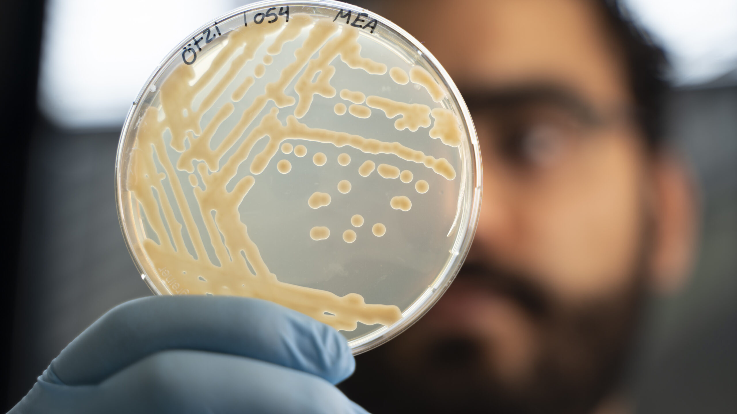 Ancient Yeast Strains Found Living on Ötzi the Iceman's Mummy